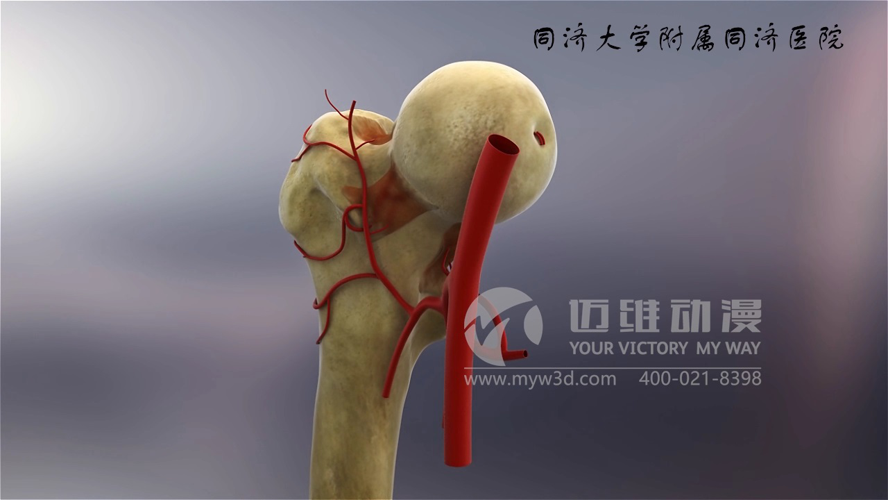 医学仿真三维动画演示