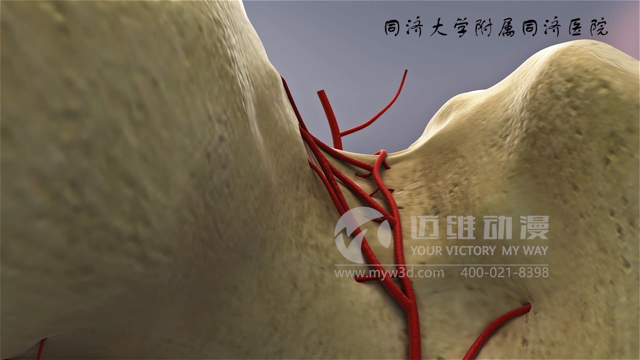 医学仿真三维动画演示