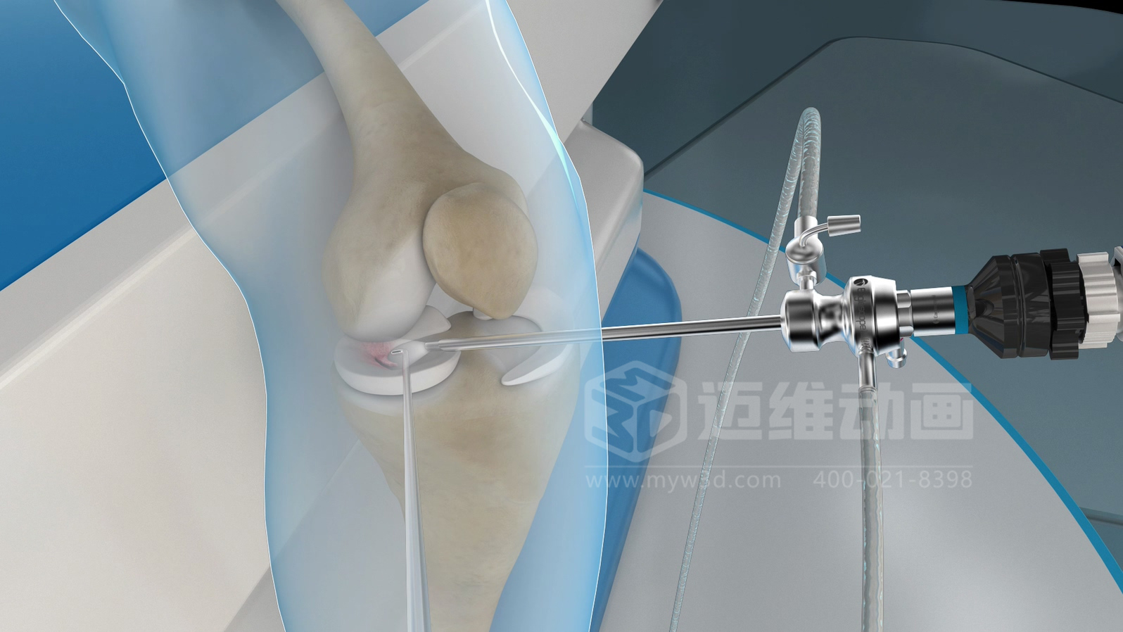 医学手术三维动画制作公司哪家好？解码上海迈维动漫的医学医疗3D可视化创新之路(图1)