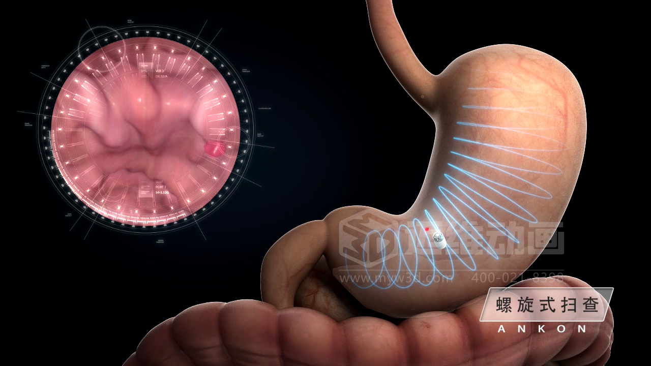 从 “看不懂” 到 “秒懂”,医学医疗三维动画凭什么兼顾专业度与传播力?(图5) 从 “看不懂” 到 “秒懂”,医学医疗三维动画凭什么兼顾专业度与传播力?(图5)